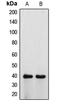 ATPase H+ Transporting V0 Subunit D1 antibody, LS-C353126, Lifespan Biosciences, Western Blot image 