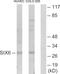 Homeobox protein SIX6 antibody, GTX87996, GeneTex, Western Blot image 