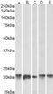 Ferritin Light Chain antibody, GTX88496, GeneTex, Western Blot image 