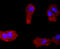 Platelet Derived Growth Factor Receptor Alpha antibody, GTX01102, GeneTex, Immunocytochemistry image 