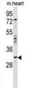 Homeobox protein orthopedia antibody, abx030129, Abbexa, Western Blot image 