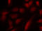 GATA Binding Protein 1 antibody, LS-C335994, Lifespan Biosciences, Immunofluorescence image 