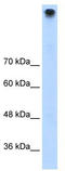 Transient Receptor Potential Cation Channel Subfamily M Member 3 antibody, TA339050, Origene, Western Blot image 