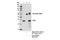 Vesicle Transport Through Interaction With T-SNAREs 1A antibody, 14764S, Cell Signaling Technology, Immunoprecipitation image 