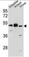 BTB Domain Containing 17 antibody, AP50400PU-N, Origene, Western Blot image 