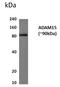 ADAM Metallopeptidase Domain 15 antibody, GTX52529, GeneTex, Western Blot image 