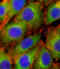 AKT Serine/Threonine Kinase 2 antibody, LS-C98940, Lifespan Biosciences, Immunofluorescence image 
