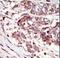 Calcium/calmodulin-dependent protein kinase type 1G antibody, LS-C100803, Lifespan Biosciences, Immunohistochemistry paraffin image 