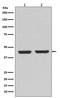 Actin Alpha 2, Smooth Muscle antibody, M01072-3, Boster Biological Technology, Western Blot image 