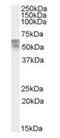 Thyroid Hormone Receptor Alpha antibody, orb19580, Biorbyt, Western Blot image 
