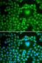 Protein Phosphatase 1 Catalytic Subunit Beta antibody, LS-C748575, Lifespan Biosciences, Immunofluorescence image 