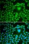 Serine/threonine-protein phosphatase PP1-beta catalytic subunit antibody, LS-C748575, Lifespan Biosciences, Immunofluorescence image 