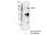 CYLD Lysine 63 Deubiquitinase antibody, 4495S, Cell Signaling Technology, Immunoprecipitation image 