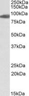 Glutamate dehydrogenase 1, mitochondrial antibody, 42-524, ProSci, Western Blot image 