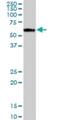 Proline And Arginine Rich End Leucine Rich Repeat Protein antibody, H00005549-B01P, Novus Biologicals, Western Blot image 