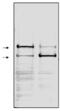 Poly(ADP-Ribose) Polymerase 1 antibody, BML-SA249-0050, Enzo Life Sciences, Western Blot image 