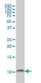 PHS antibody, LS-C197849, Lifespan Biosciences, Western Blot image 