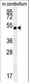 Shisa Family Member 7 antibody, LS-C166813, Lifespan Biosciences, Western Blot image 
