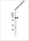 Fibrinogen Alpha Chain antibody, A00816, Boster Biological Technology, Western Blot image 