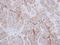 Aspartyl-TRNA Synthetase 2, Mitochondrial antibody, GTX116291, GeneTex, Immunohistochemistry paraffin image 