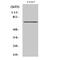 Spleen Associated Tyrosine Kinase antibody, A00490Y525-1, Boster Biological Technology, Western Blot image 