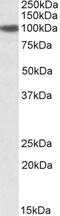 Sperm Associated Antigen 16 antibody, 42-304, ProSci, Enzyme Linked Immunosorbent Assay image 