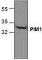 Pim-1 Proto-Oncogene, Serine/Threonine Kinase antibody, TA318959, Origene, Western Blot image 
