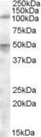 Endoplasmic Reticulum Aminopeptidase 2 antibody, GTX88698, GeneTex, Western Blot image 