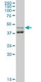 Serine/Threonine/Tyrosine Kinase 1 antibody, H00055359-M03, Novus Biologicals, Western Blot image 
