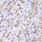Cathepsin D antibody, LS-C331569, Lifespan Biosciences, Immunohistochemistry frozen image 