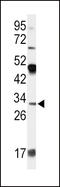 Apolipoprotein D antibody, MBS9214572, MyBioSource, Western Blot image 