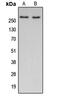 Acetyl-CoA Carboxylase Alpha antibody, GTX54946, GeneTex, Western Blot image 