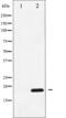 Protein Phosphatase 1 Regulatory Inhibitor Subunit 14A antibody, abx011369, Abbexa, Western Blot image 