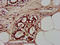 Chloride Voltage-Gated Channel Kb antibody, CSB-PA005488LA01HU, Cusabio, Immunohistochemistry paraffin image 