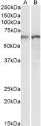 Aryl Hydrocarbon Receptor Nuclear Translocator antibody, 43-503, ProSci, Western Blot image 