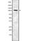 Reversion Inducing Cysteine Rich Protein With Kazal Motifs antibody, abx218237, Abbexa, Western Blot image 