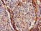Interferon Induced Transmembrane Protein 2 antibody, LS-C395924, Lifespan Biosciences, Immunohistochemistry paraffin image 