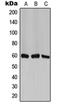 Chaperonin Containing TCP1 Subunit 6A antibody, orb213681, Biorbyt, Western Blot image 