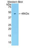 Coagulation Factor VIII antibody, LS-C302623, Lifespan Biosciences, Western Blot image 