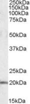 U2 Small Nuclear RNA Auxiliary Factor 1 Like 4 antibody, NBP1-06996, Novus Biologicals, Western Blot image 