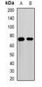 Matrix Metallopeptidase 25 antibody, orb378181, Biorbyt, Western Blot image 
