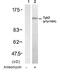 Tyrosine Kinase 2 antibody, GTX38580, GeneTex, Western Blot image 