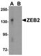 Zinc Finger E-Box Binding Homeobox 2 antibody, A01169, Boster Biological Technology, Western Blot image 