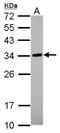 Tubulin Polyglutamylase Complex Subunit 2 antibody, NBP2-20687, Novus Biologicals, Western Blot image 