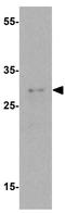 Retinoic Acid Early Transcript 1E antibody, GTX32159, GeneTex, Western Blot image 