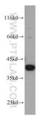 MCL1 Apoptosis Regulator, BCL2 Family Member antibody, 16225-1-AP, Proteintech Group, Western Blot image 