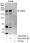 Kinase D Interacting Substrate 220 antibody, A303-003A, Bethyl Labs, Immunoprecipitation image 