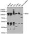 Eukaryotic Elongation Factor 2 Kinase antibody, GTX32573, GeneTex, Western Blot image 