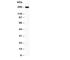 Integrin Subunit Beta 4 antibody, R30790, NSJ Bioreagents, Western Blot image 