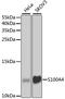 S100 Calcium Binding Protein A4 antibody, STJ25431, St John